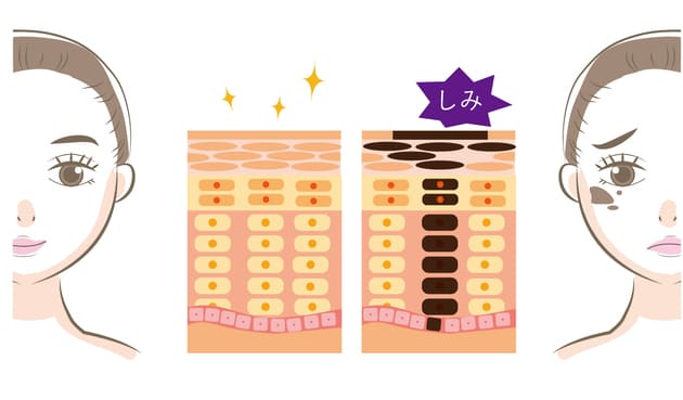 シミ予備軍を消す!今日から始めるシミを防ぐ最強の方法 肌のターンオーバー
