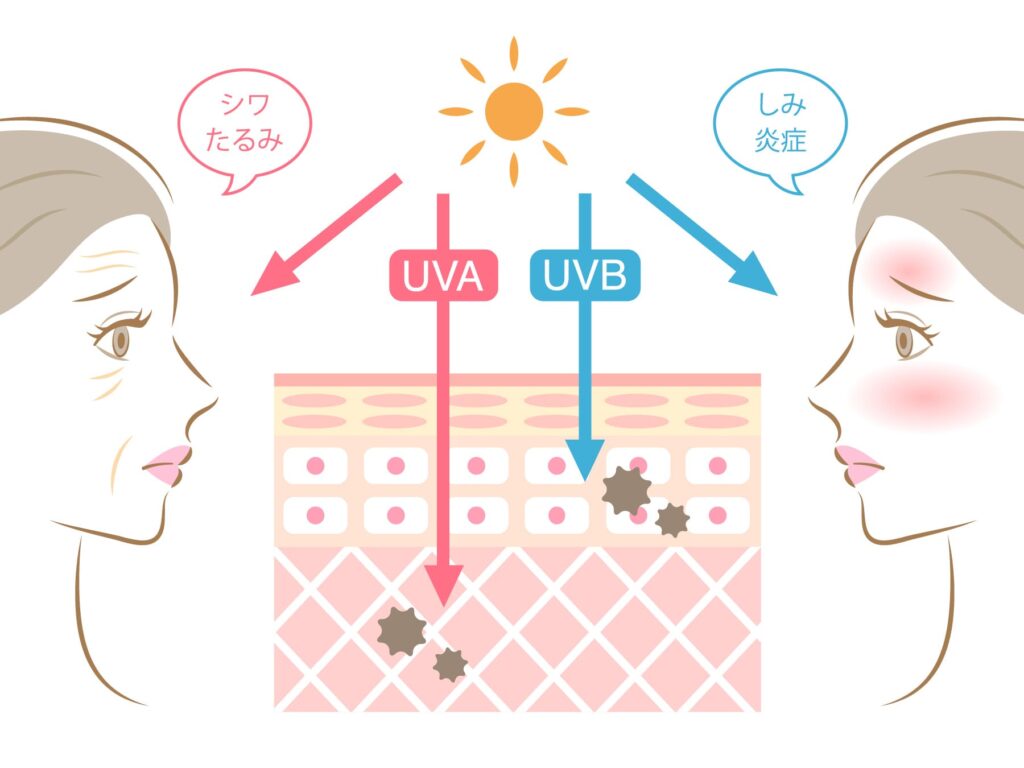 UV-AとUV-Bの肌への影響の違い