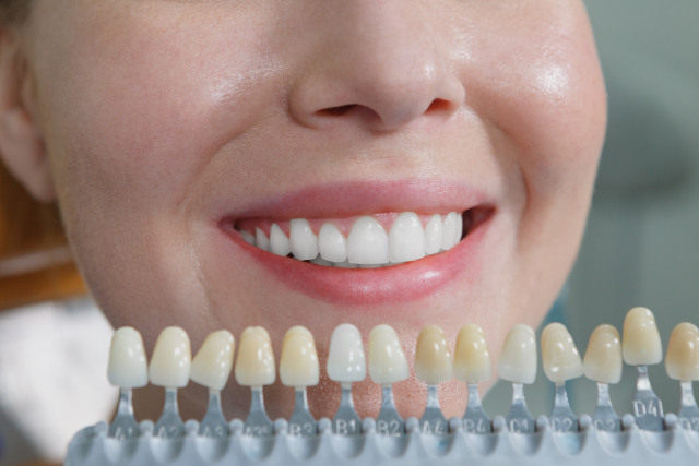 真っ白な歯の女性