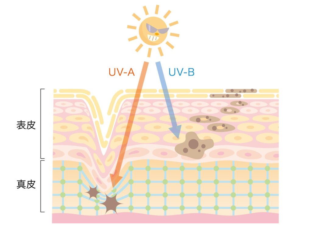 UV-AとUV-Bにさらされている肌